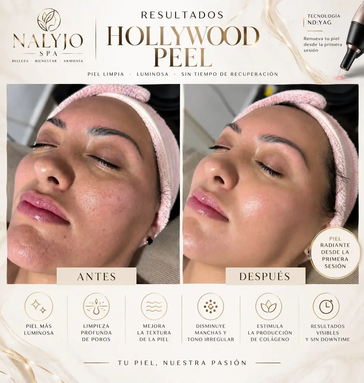 Resultado de tratamiento Hollywood Peel: antes y después