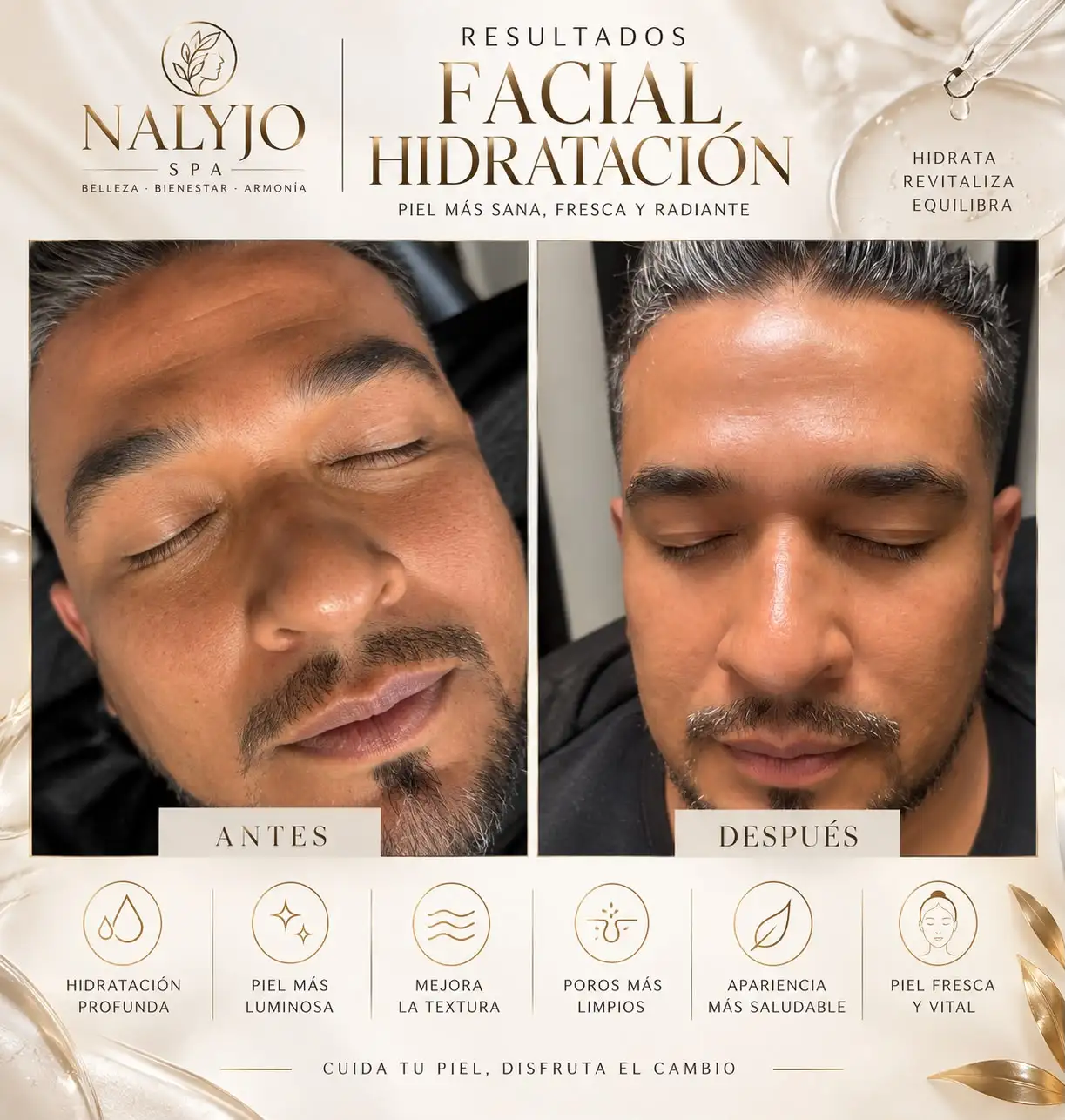 Resultado de Facial de Hidratación profunda en hombre: antes y después