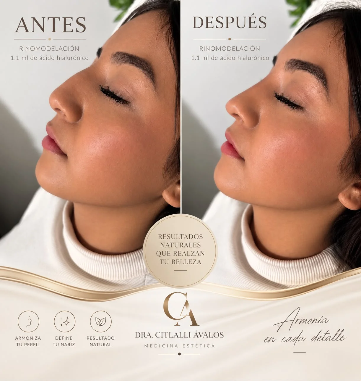 Resultado de tratamiento facial estético: antes y después
