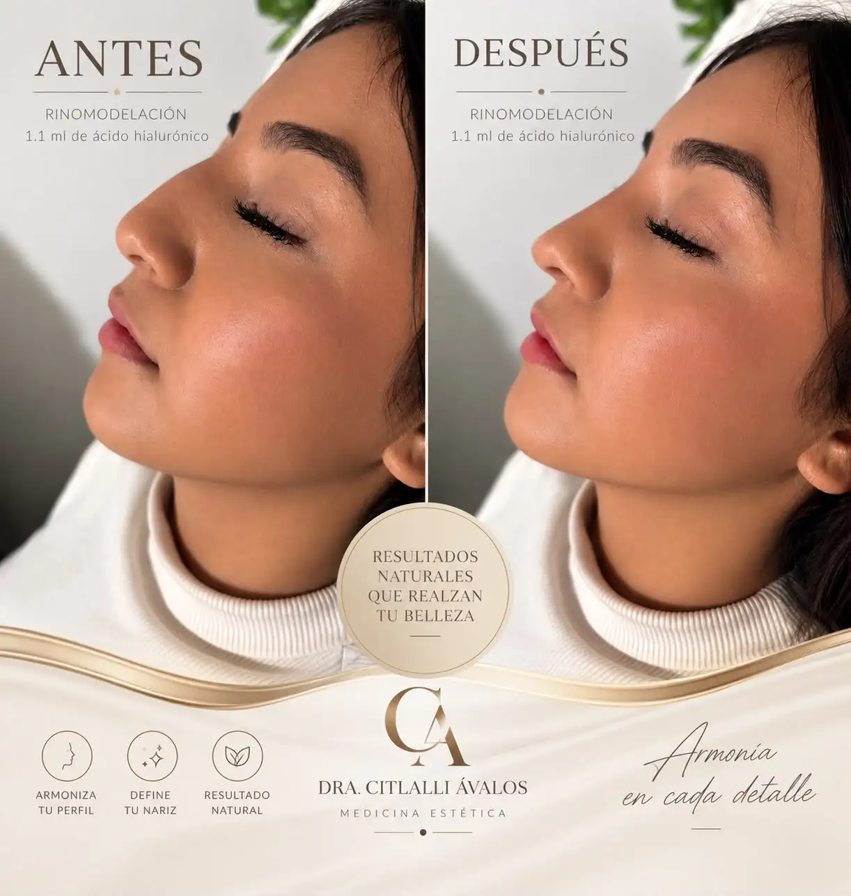 Resultado de tratamiento facial estético: antes y después